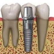 Eurodente