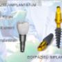 Egyfázisú implantátum vs. kétfázisú implantátum