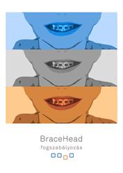 Bracehead - Fogszabályozás