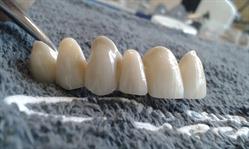 Martondental Fogtechnika
