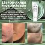 Skin Booster