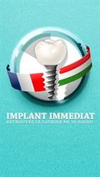IMPLANT IMMEDIAT