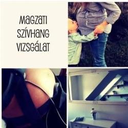 CTG- Magzati szívhang vizsgálat