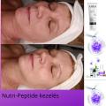 Nutri Peptide kezelés