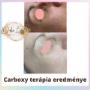 Carboxy terápia eredménye