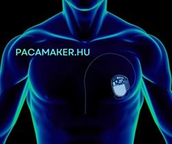 Pacemaker.hu
