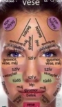 Facelift kezelés
