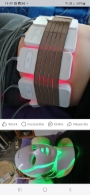 Alakformálás lipolézerrel