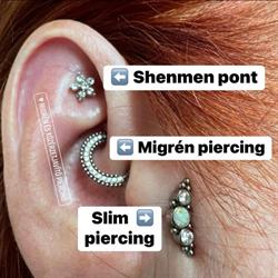 ShenMen pont, Migrén és Étvágycsökkentő (Slim) piercing GYŐR - BUDAPEST