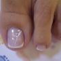 pedi3