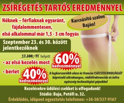 kedvezmények