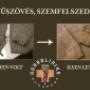 Műszövés szemfelszedés