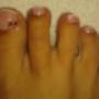 pedi zselé 2