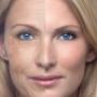 Anti-aging