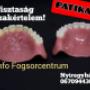 Denfo Fogsorcentrum