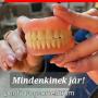 Egy fullos fogsor mindenkinek jár!