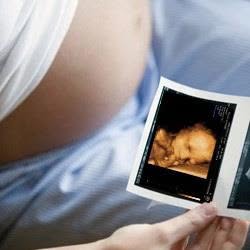 CsodaBent 3D/4D Magzati Ultrahang Stúdió