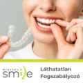 DigitalSmile Láthatatlan Fogszabályozó